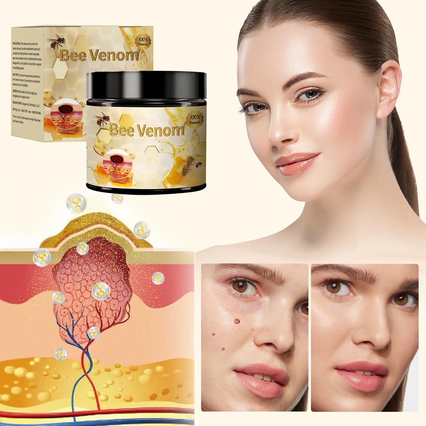 Bee Venom Skin Treatment Cream SKU: WB-UA1797 Bundl of 02 pieces