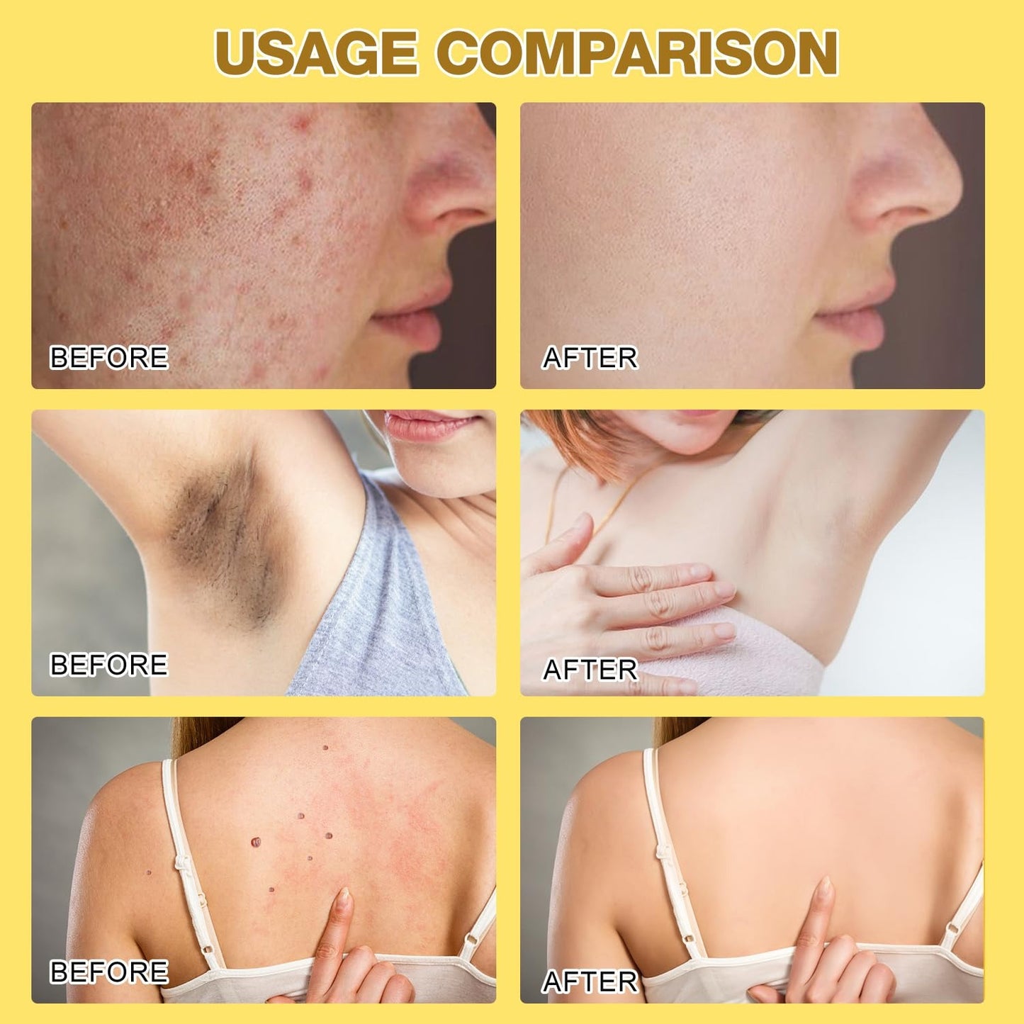 Bee Venom Skin Treatment Cream  SKU: WB-UA1797 Bundl of 02 pieces